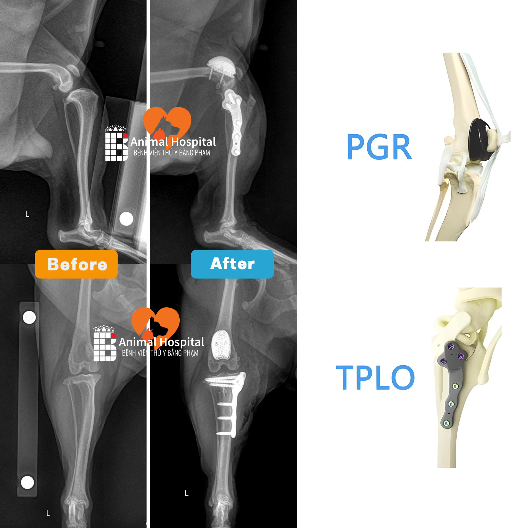 phương pháp TPLO & PGR