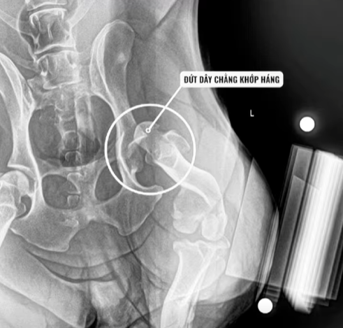 chó bị đứt dây chằng khớp háng
