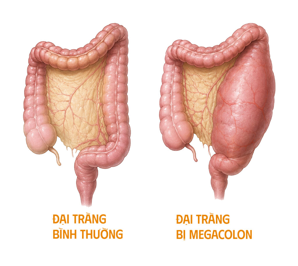 chó bị megacolon